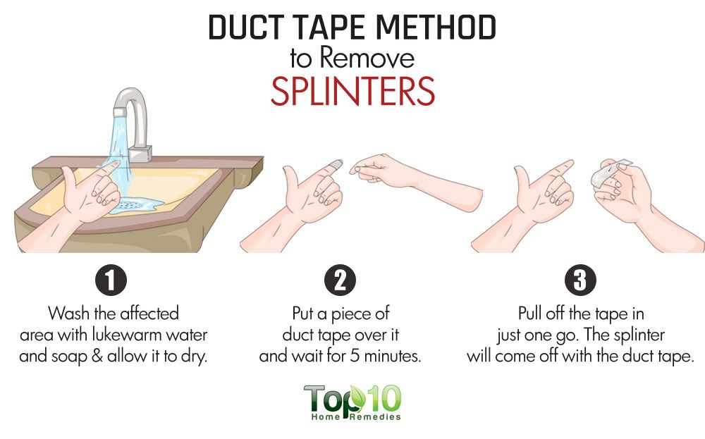 How to remove a splinter
